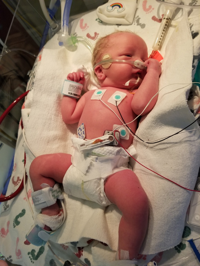 Gideon in the NICU Gideon in the NICU